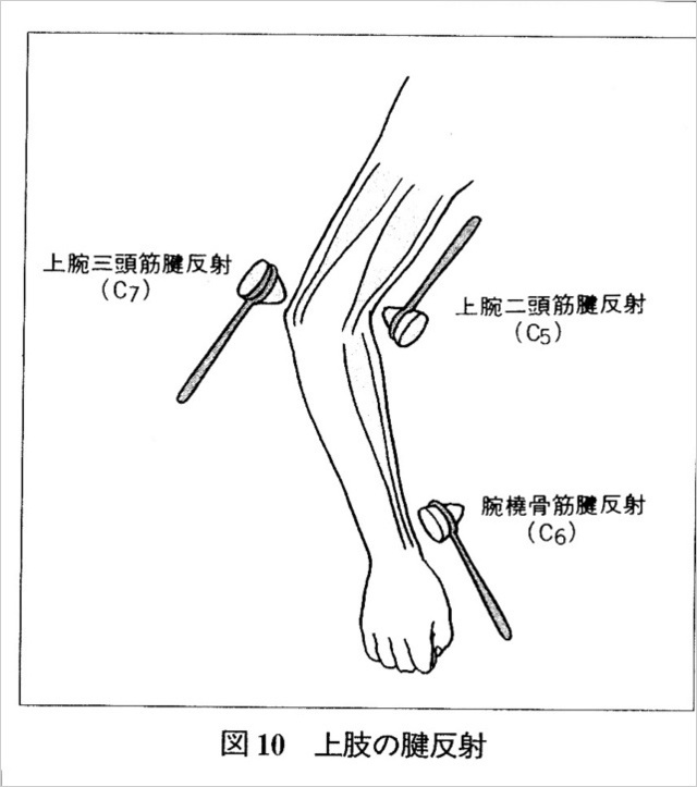 図10 上肢の腱反射