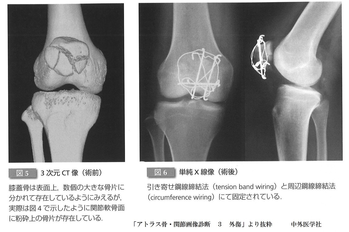 毎日の記事